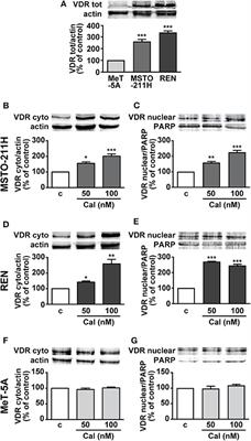 Calcitriol Inhibits Viability and Proliferation in Human Malignant Pleural <mark class="highlighted">Mesothelioma Cells</mark>